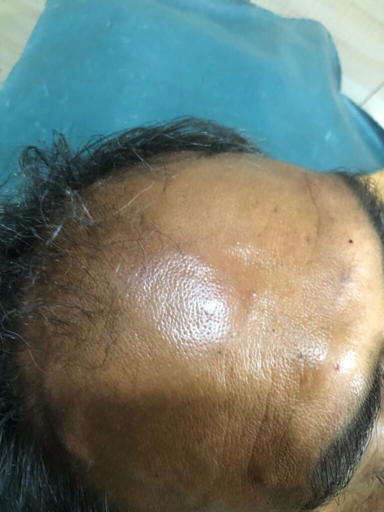 LRG Hair Growth Treatment